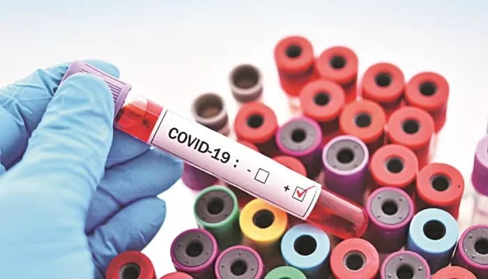 Latest news: Corporates Hit the Panic Button as COVID- Surges Again! - SightsIn Plus